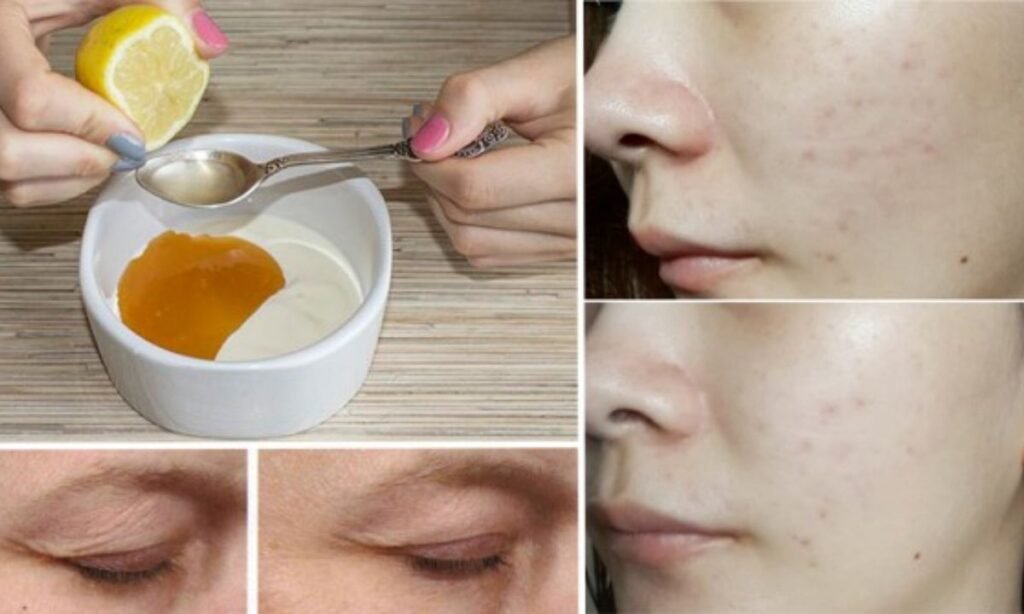 How to Use Lemon Juice and Tang for Dark Spots